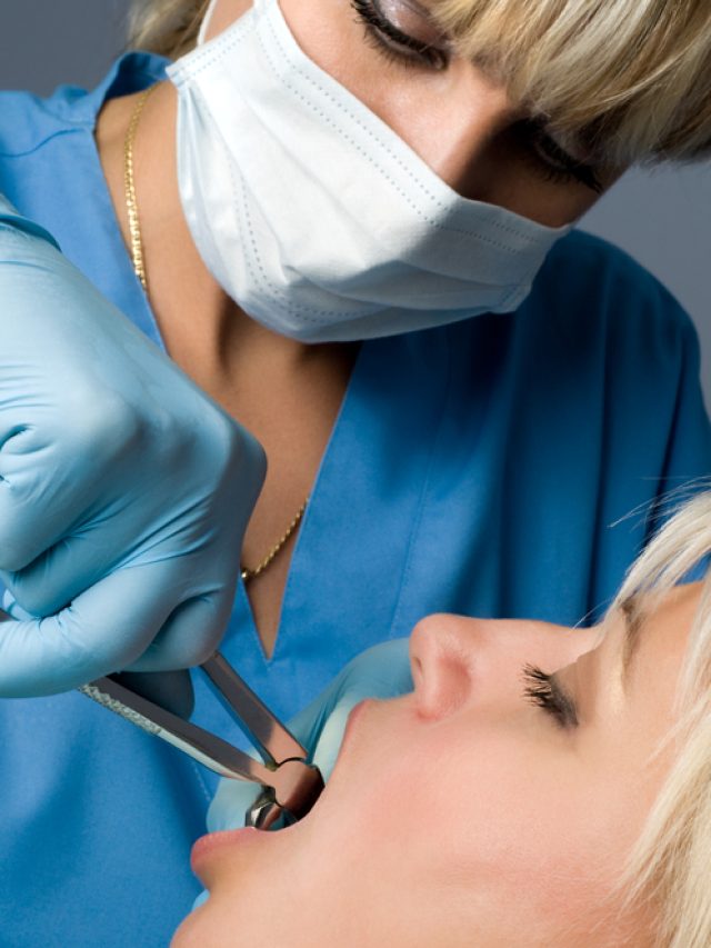 How Simple Surgical tooth extractions in in McDonough, Georgia, can assist you!